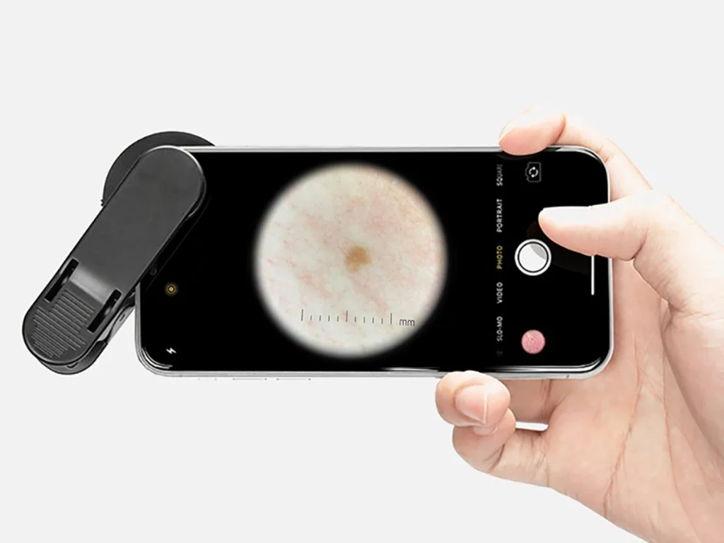 dermoscope IBOOLO DE-400 dermatoscope
