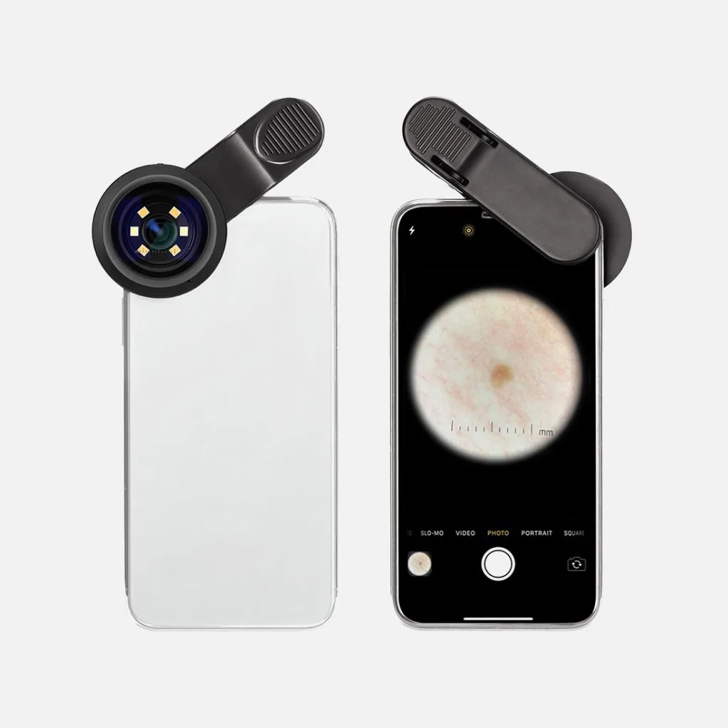 Dermatoscope DE-300
