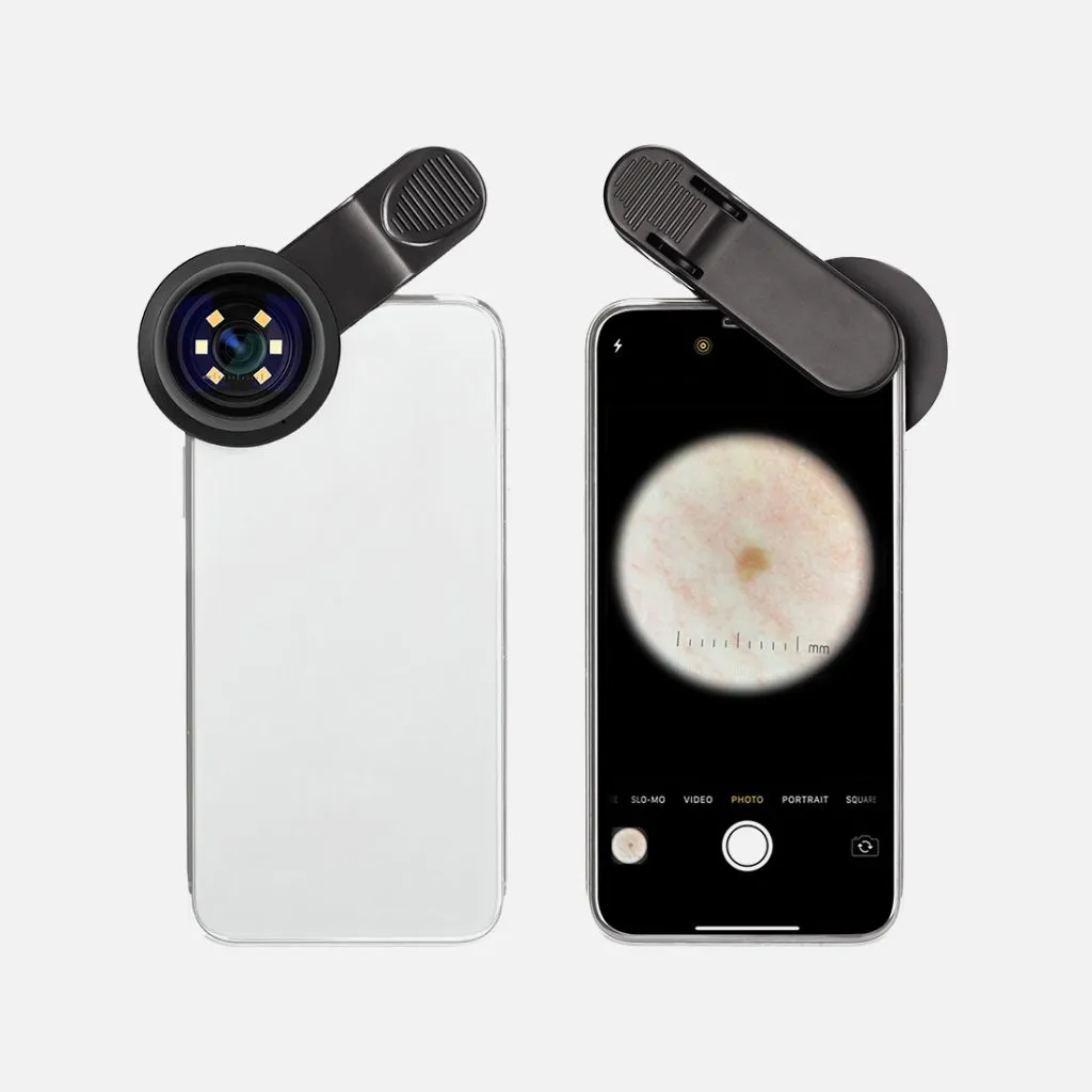 Dermatoscope DE-300