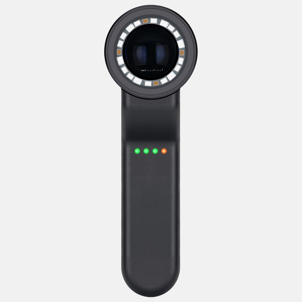 Polarized Light Dermoscopy: Clearer Skin dermatoscope Lesion