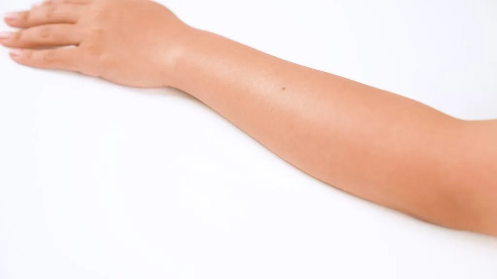 Without IBOOLO Dermatoscope