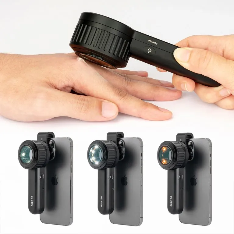 DE-3100 dermatoscope 9