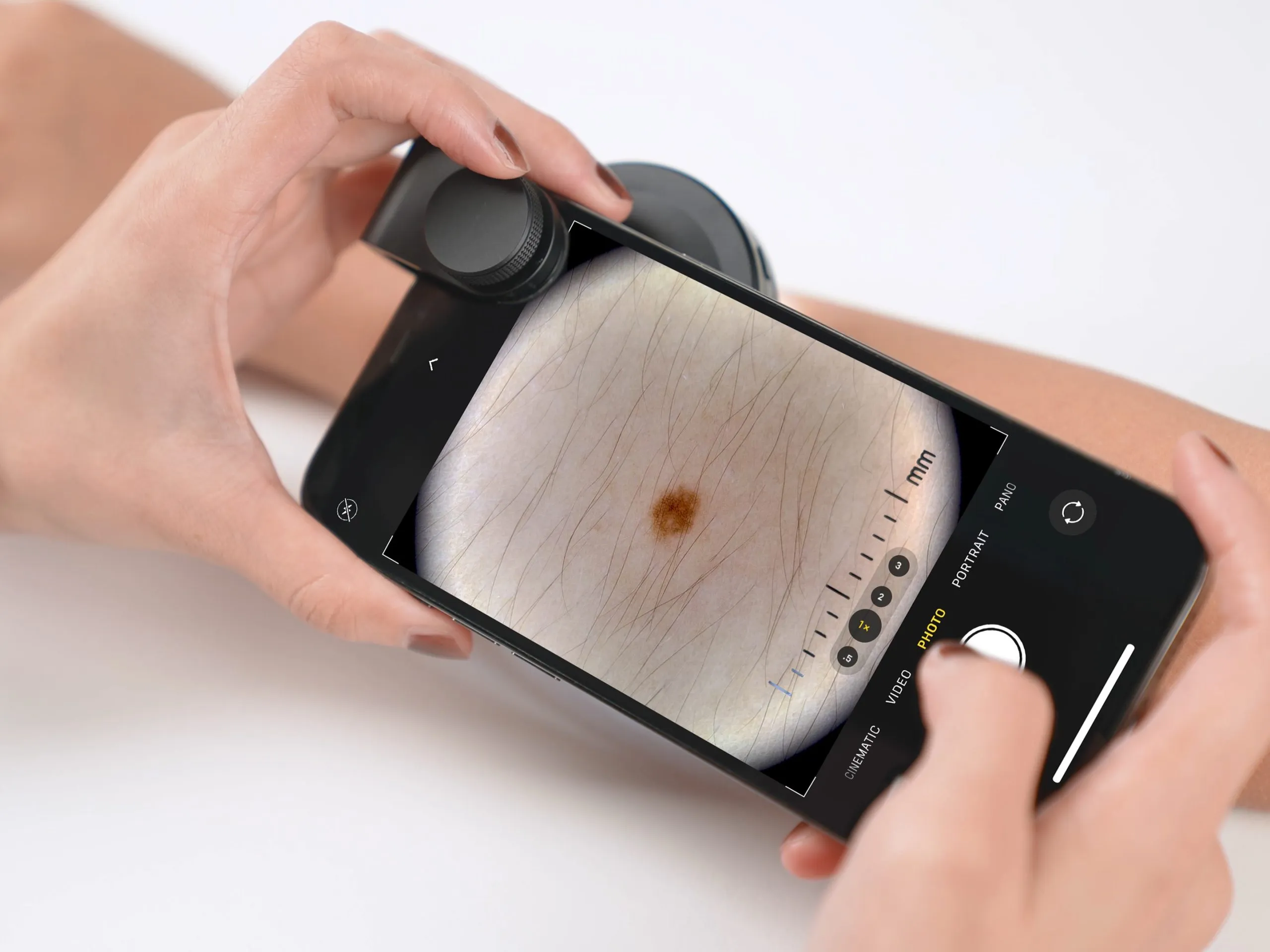 DE400 dermatoscope