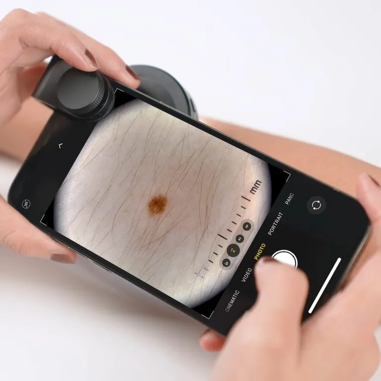 DE400 dermatoscope