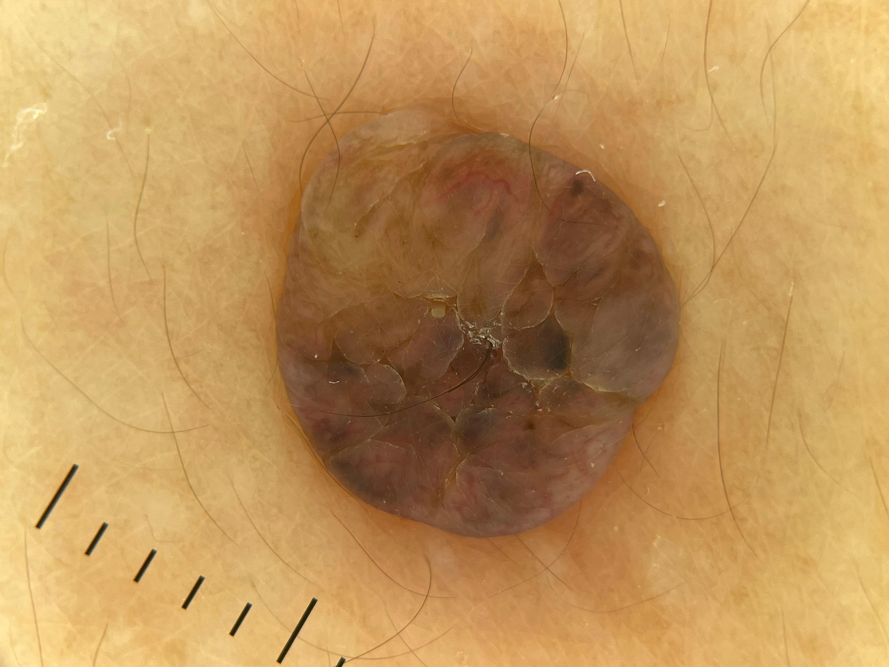 DE-3100 Polarized Effect