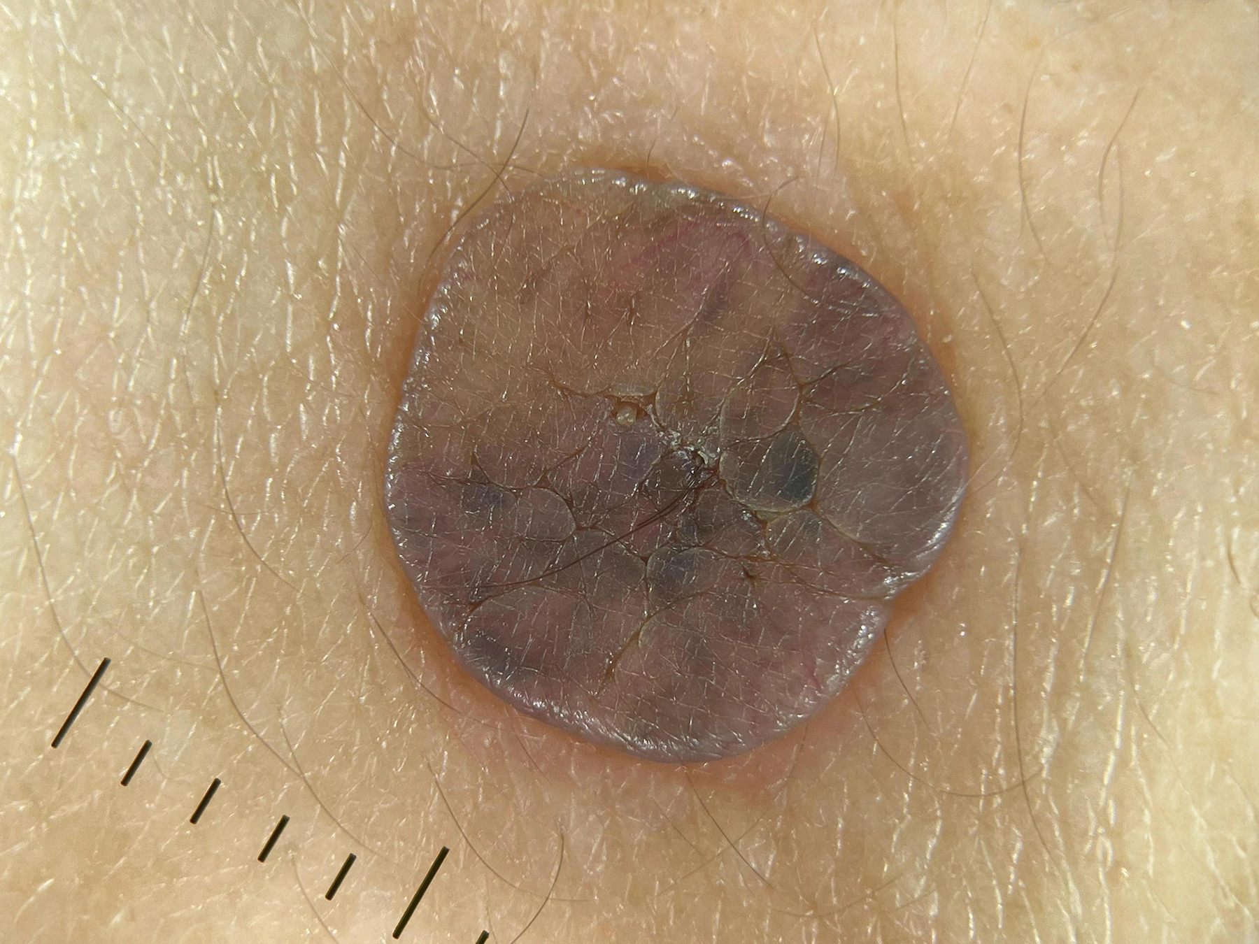 DE-3100 Non Polarized Effect