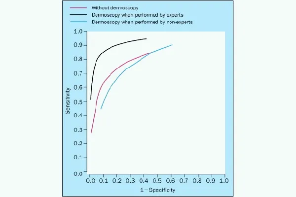 How effectiveness is dermoscopy – IBOOLO