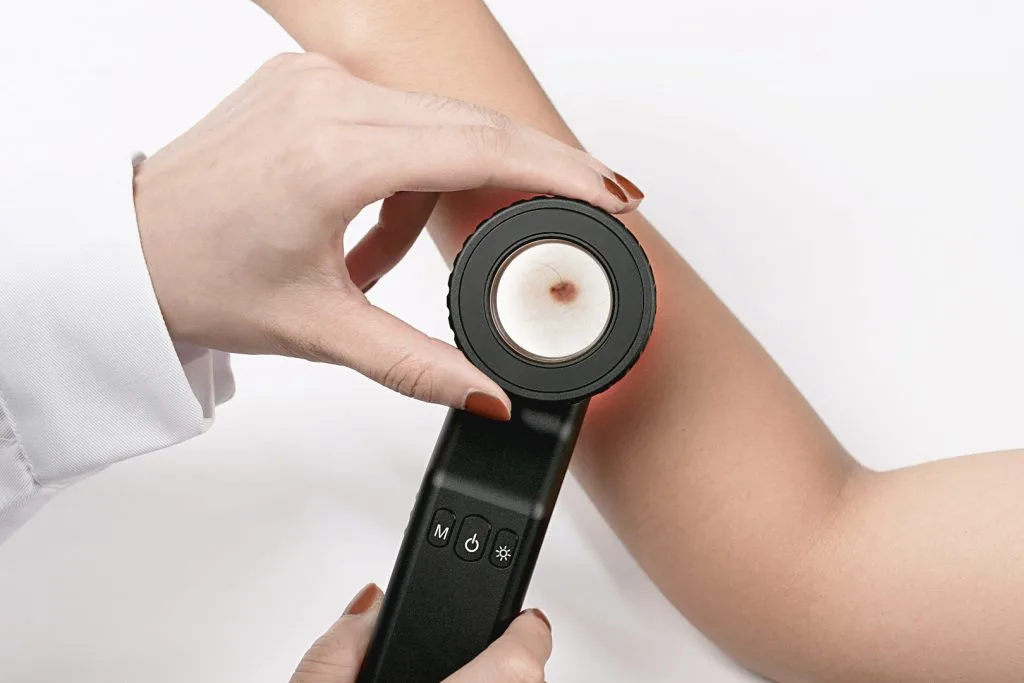 Handheld Dermatoscope