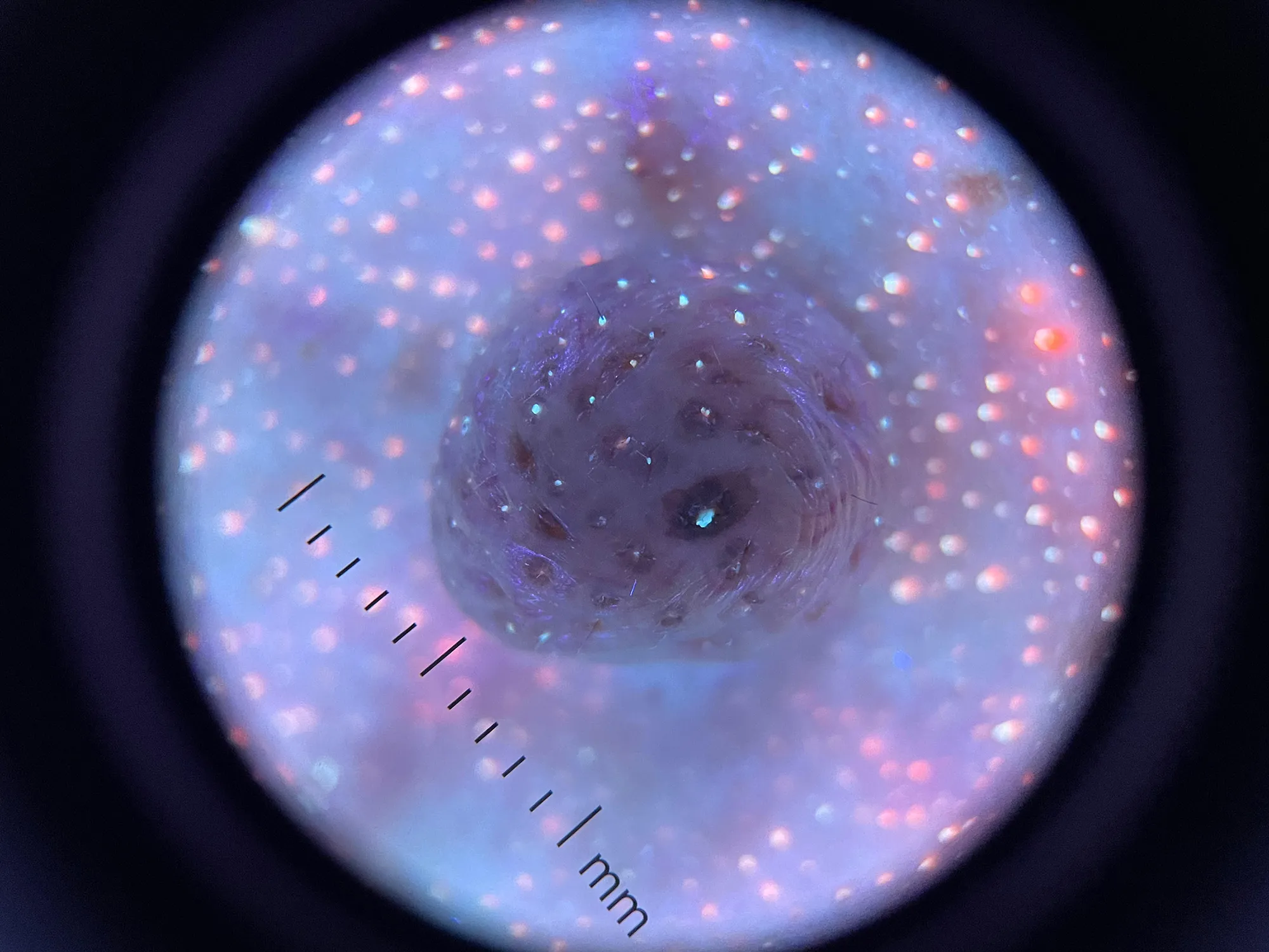 DE-3100 PRO Dermatoscope