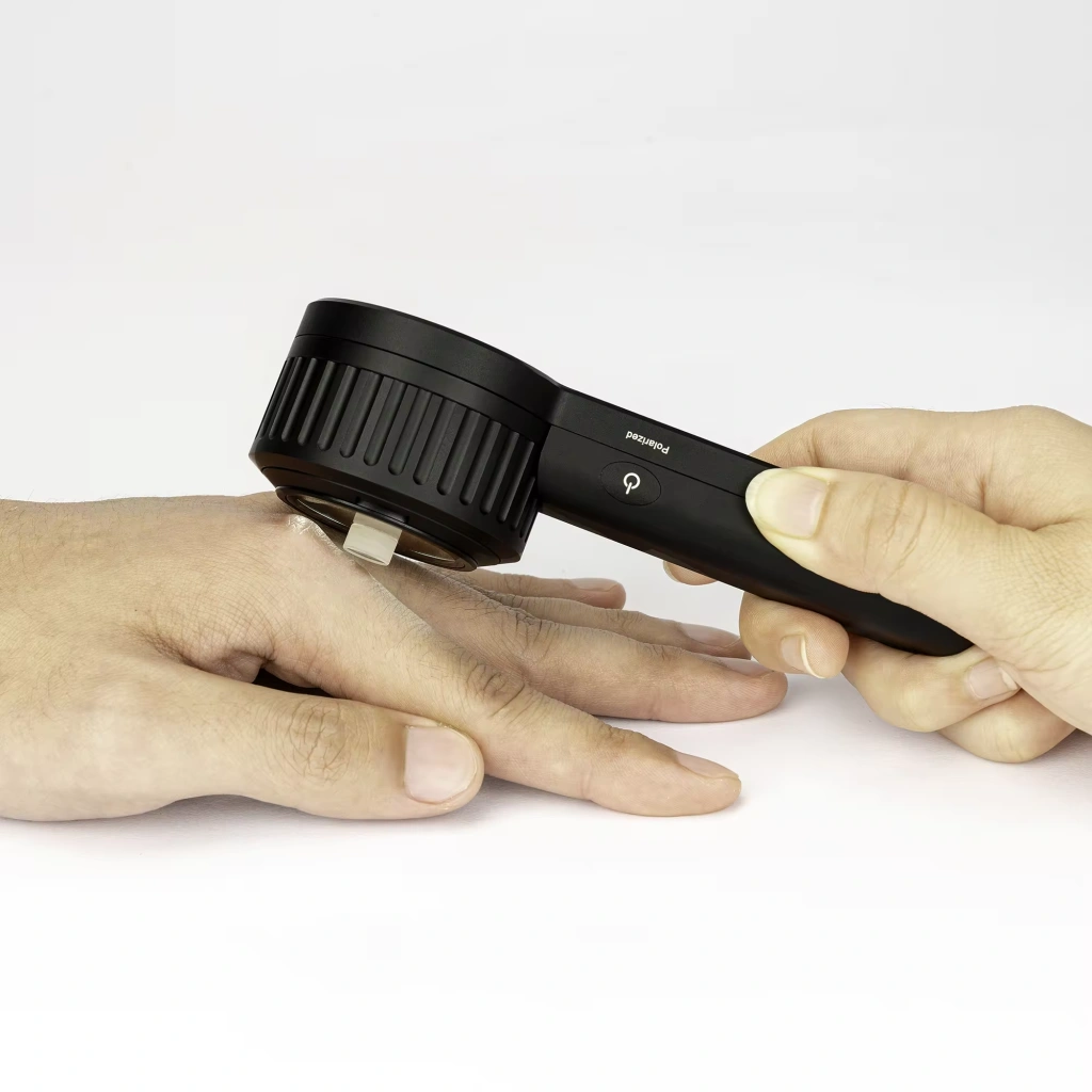 pocket dermatoscope device DE-3100
