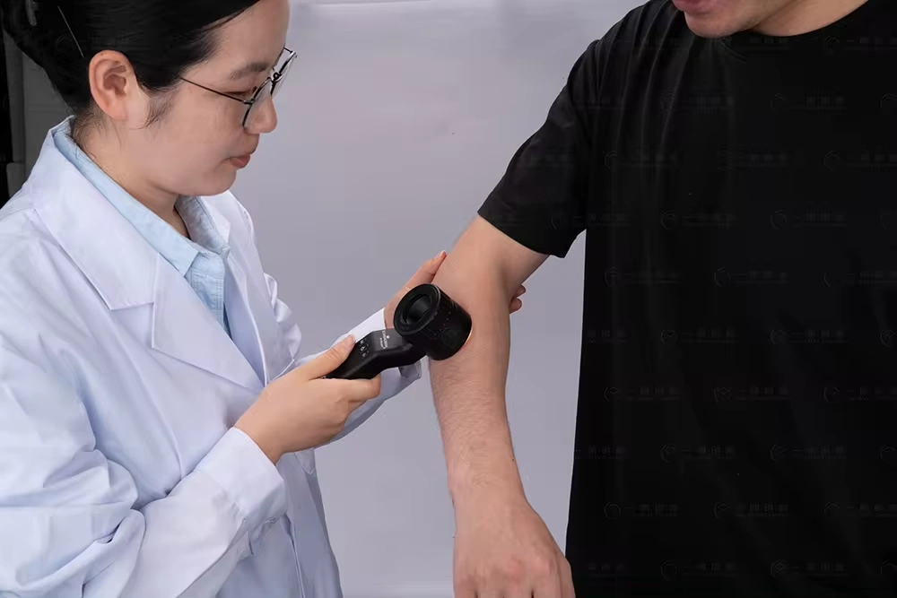 skin examination by dermatoscope