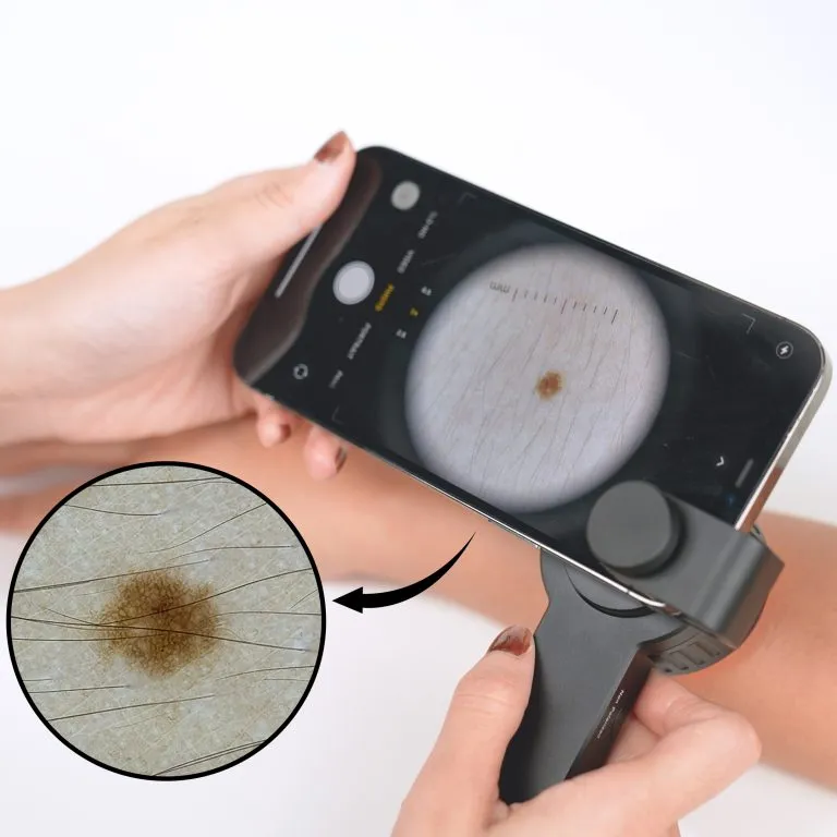 DE-3100 dermatoscope