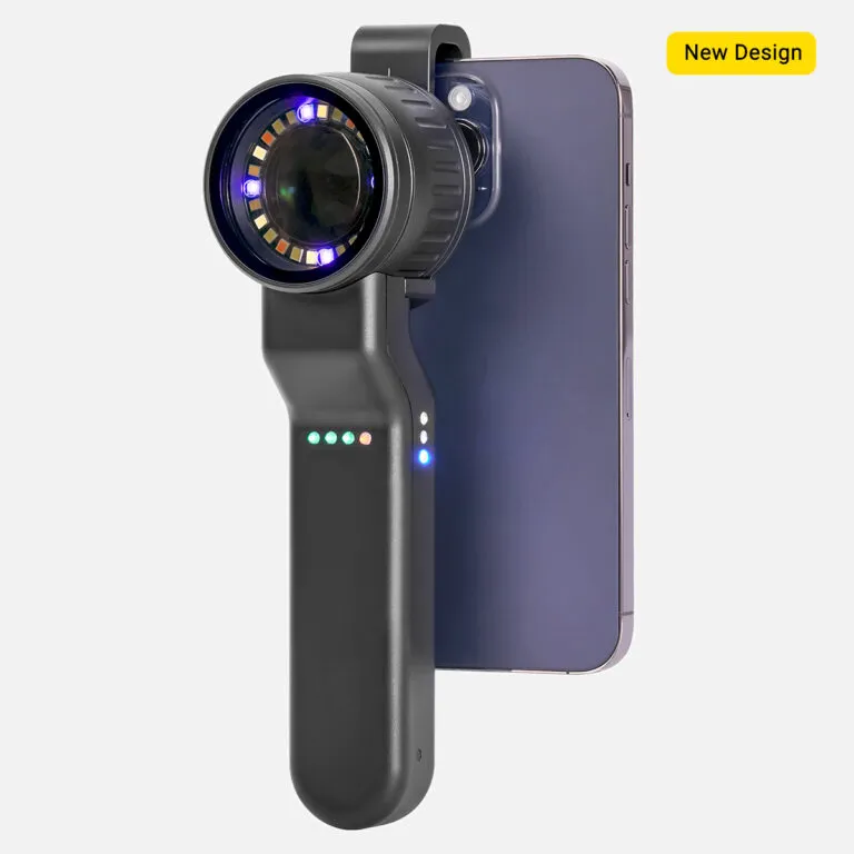 DE-4100 dermatoscope 4