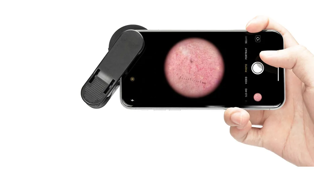 IBOOLO DE-300 Dermoscopy