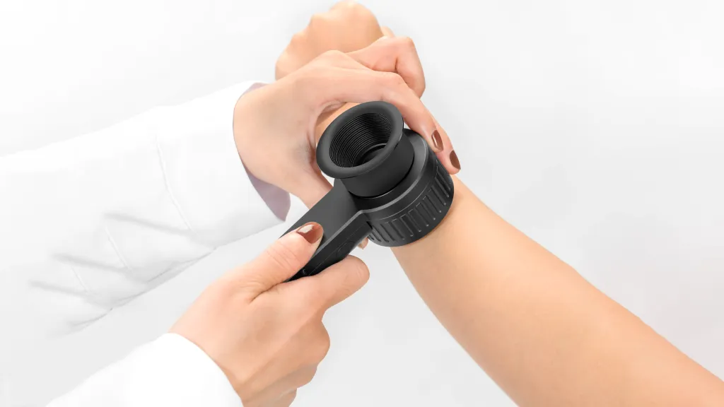 IBOOLO Dermoscopy Examination