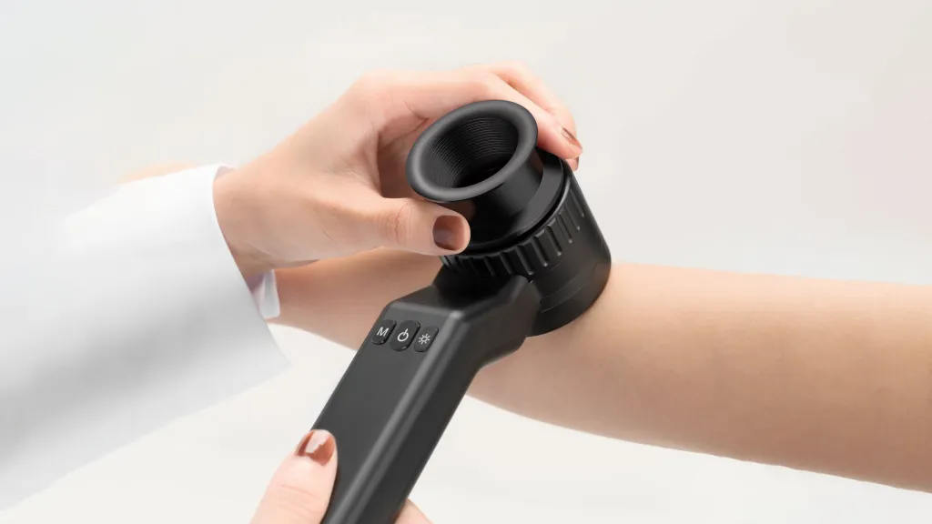 IBOOLO Dermoscopy Examination
