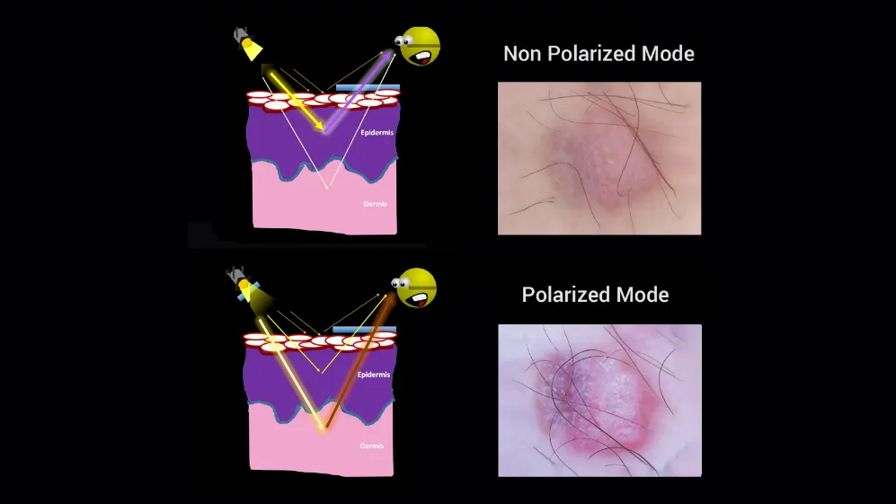 Polarised VS. Non-polarised