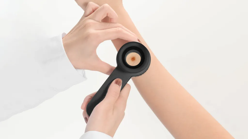 IBOOLO DE-3100 Dermatoscope Nake Eyes Observation