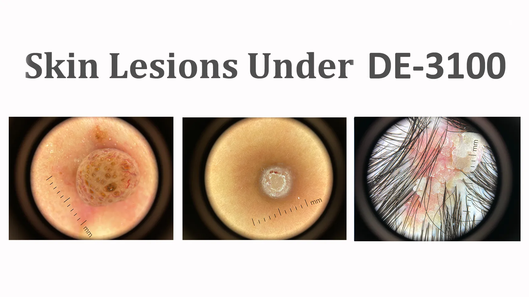 IBOOLO DE-3100 Cover