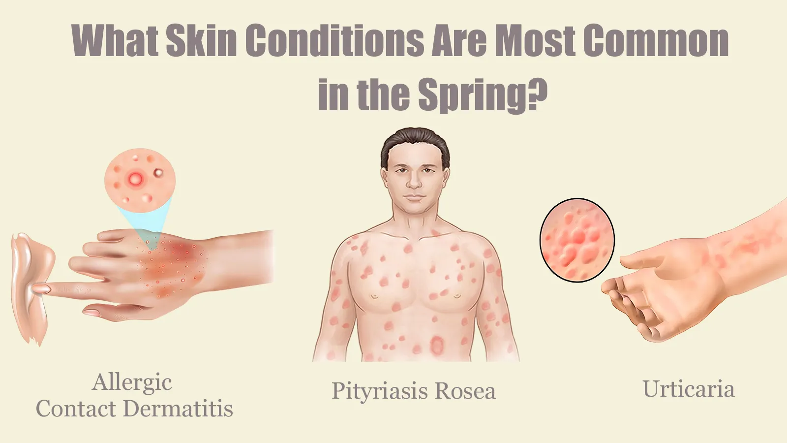 skin conditions in the spring cover