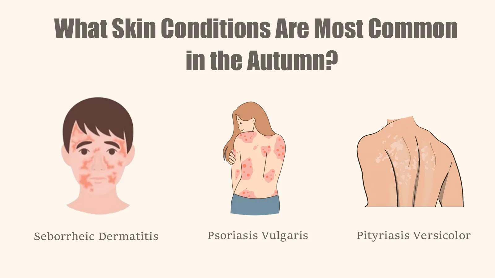 Skin Conditions Are Most Common in the Autumn COVER