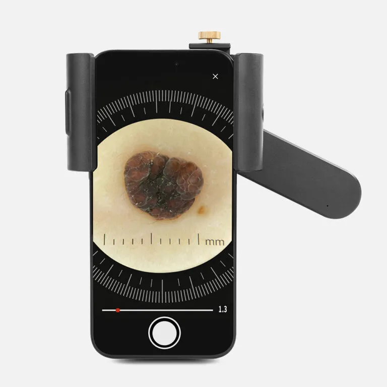 Universal Phone Adapter for DE-3100 2