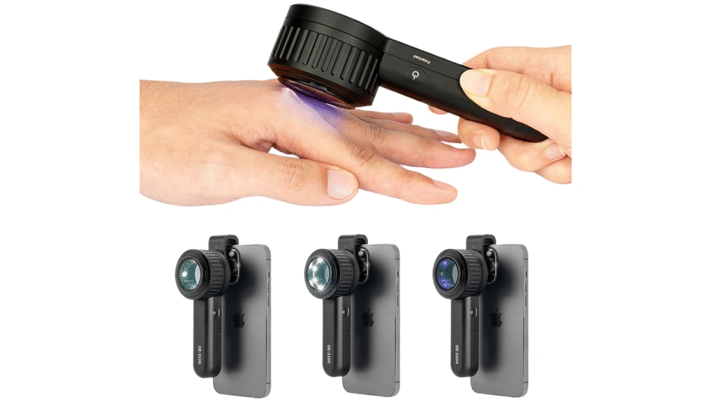 IBOOLO DE-3100 PRO Dermatoskop