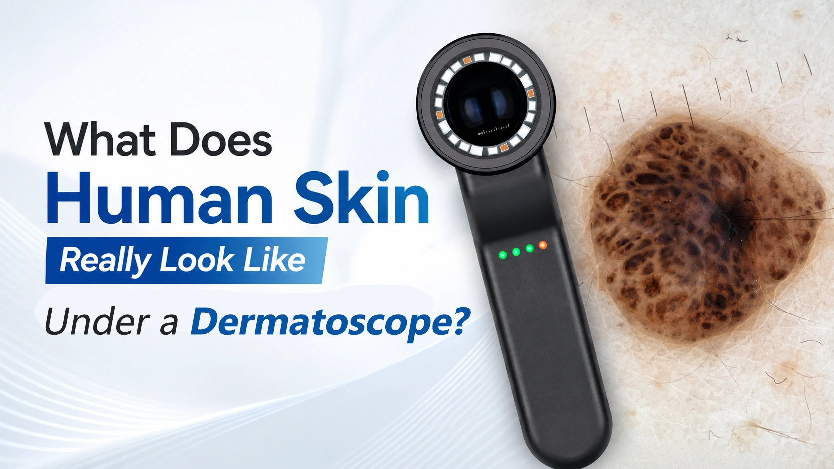 human skin under a dermatoscope cover
