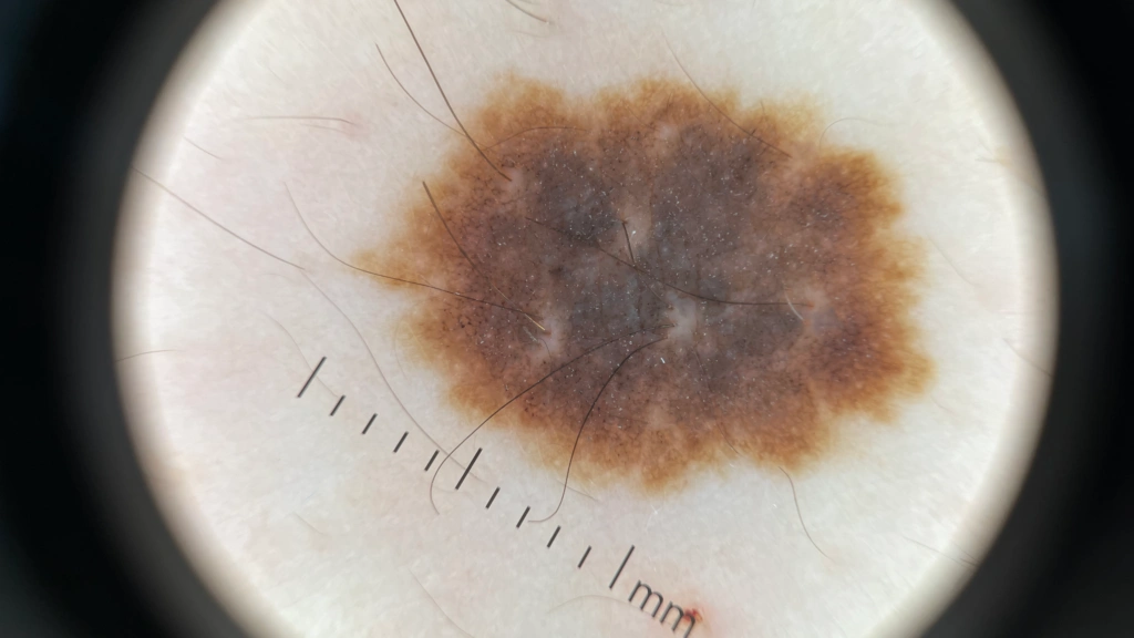 IBOOLO DE-5100 polarized light