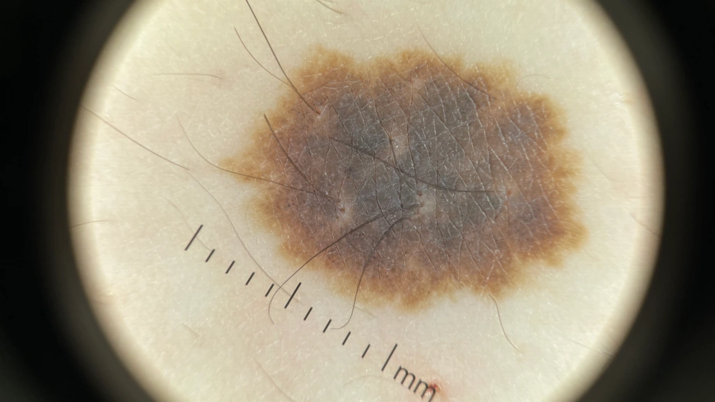IBOOLO DE-5100 Parallel-polarized light